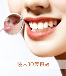 圣愛(ài)3D美容冠