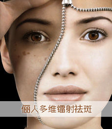 圣愛(ài)多維鐳射祛斑